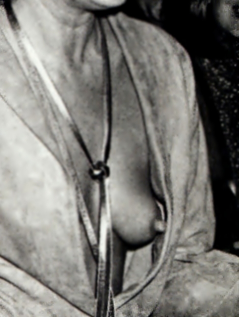naked teen girls with big boobs bending over board of facial plastic surgery